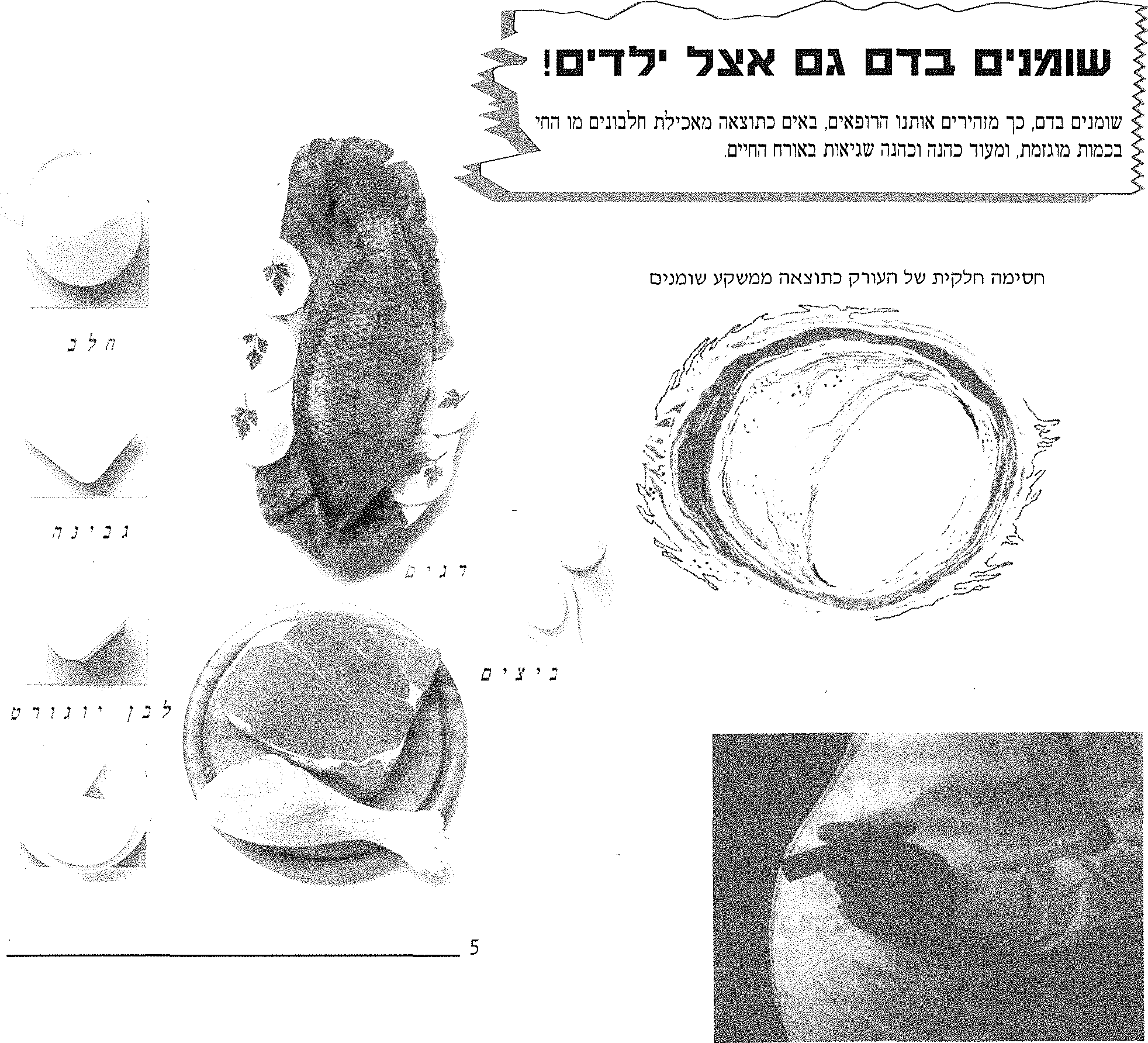 חסימה חלקית של העורק כתוצאה ממשקע שומנים: ביצים, דגים, חלב, גבינה, לבן, יוגורט
